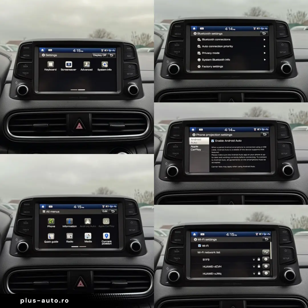 Hyundai Kona 1.6 Select Edition